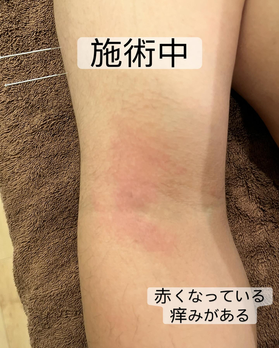 画像318