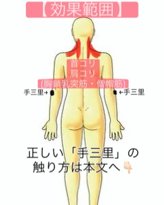 画像323