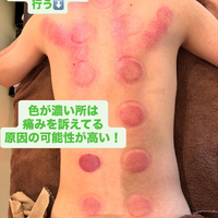 画像424
