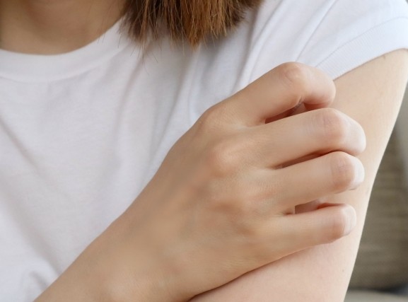 【 アトピー性皮膚炎を和らげる 】あなたの生活が変化する　お悩みの方、横須賀市大津町のつぼみ鍼灸院まで！